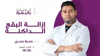 إزالة البقع الداكنة  -الدكتور عمري حمزة