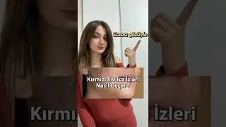 Kırmızı sivilce izlerine gizli eczacı &ccedil;&ouml;z&uuml;m&uuml;!