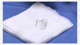 Traitement de l'emphys&egrave;me pulmonaire - Spirales endobronchiques &ndash; Dr Thomas Egenod, CHU de Limoges.
