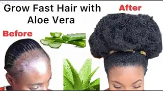 I Used This DIY ALOE VERA Natural Hair Conditioner to Stop Hair fall
