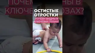 Why are the spinous processes visible in key poses?