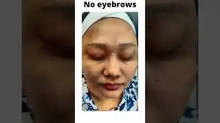 VJ Thapa Raghu Permanent Eyebrows | Dr Aesthetix Cosmetic Clinic Chennai|#AesthetixwithDrHemamalini