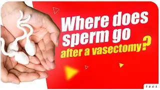 What happens to sperm after a vasectomy? | Facts about human body