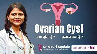 Ovarian Cyst क्या होता है?