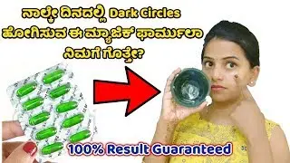 ಡಾರ್ಕ್ ಸರ್ಕಲ್ಸ್ ಗೆ ಸುಲಭ ಪರಿಹಾರ How to remove Dark circles in kannada Shridevi Vlogs Vitamin E capsul