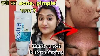Vlcc wellscience extra clear face wash honest Review | vlcc product | फायदे और नुकसान