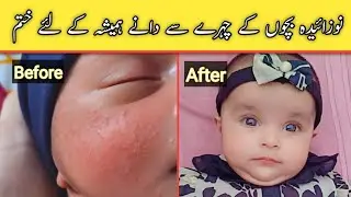 How to cure newbornbaby baby face acne | Rashes on baby face | newborn baby ki skin py danon ka ilaj