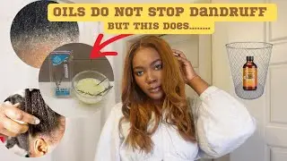 I use ROSEMARY Water to STOP Itchy Scalp | Step by Step Recipe| Say Goodbye to Dandruff!