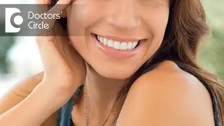 What are the options for smile makeover? - Dr. Raju Srinivas