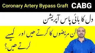 What Is CABG | How Is Coronary Artery Bypass Graft Done | Indications Of CABG