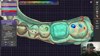 Complete Guide: Copying Pre-Op Scans for Perfect Nightguard & Retainer Fit on New Crowns in Exocad