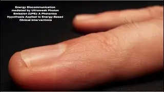 Biofield Therapies and Energy Biocommunication: A Photonics Hypothesis.