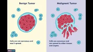 From diagnostic measurements to actions: an AI system supporting early breast cancer detection