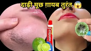 Stop Shaving👉ये मामूली सी चीज दाढ़ी,मूछ को ऐसे साफ किया😱हैरान हूं । facialhairremoval at home