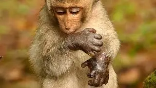 Million Sad Poor Baby Janet Swelling Hand Extreme | Baby Janet Hurt and Painful |  Baby Janet Hungry