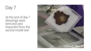 Foam Dressing Comparison   ALLEVYN Life vs CutimedTM Siltec B
