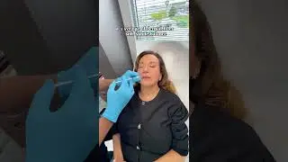 Facial Fillers for Volume & Contour |  Refreshed Results #medspa #dermalfillers #indianapolis