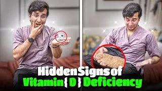 5 Hidden Symptoms of Vitamin D Deficiency You Need to Know
