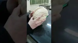 شرح عملي لتركيب الدماغ