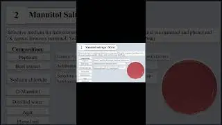 Mannitol Salt Agar (MSA) I Purpose and Composition I Selective Media I Bacterial Culture Media