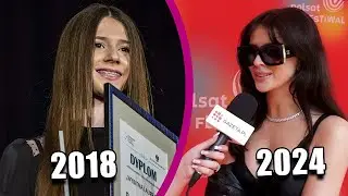 Roxie WĘGIEL zdradza, czy powiększyła usta i jakie zabiegi sobie zrobiła