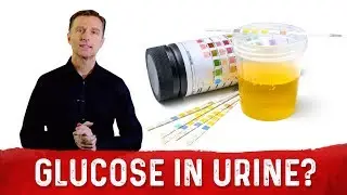Dangers of Glucose In Your Urine &ndash; Dr.Berg