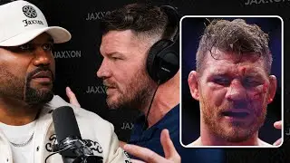 How Much Pain is Michael Bisping in?