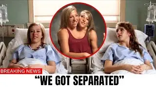 After the Surgery, Abby and Brittany Share Their New Lives