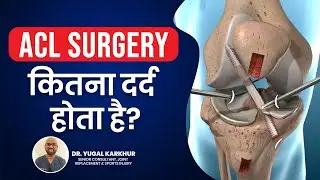 ACL Knee Surgery &ndash; कितना दर्द होता है? | ACL surgery के बाद कितने दिनो तक दर्द या सूजन रह सकती हे