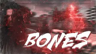 ❤BONES - CS:GO