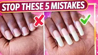 If You Want Long Natural Nails, STOP Doing These 5 Things