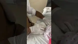 خلوا بالكم ‼️ الجبس بالكتير شهر ونص مش اكتر ‼️ والعمليه بعد الجبس مش قبله ‼️ ربنا يجعلنا سبب للشفاء