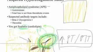 Hypercoagulable state - blood clots