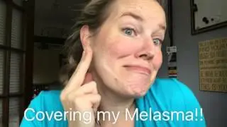 Covering Hyperpigmentation, & Melasma in 3 Steps! Primer, Concealer, Foundation