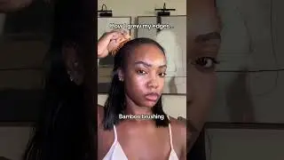 How I grew my edges back #naturalhairgrowthproducts