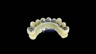 Full Zirconium Bridges Support Titanium I Bar By Camlab laboratory