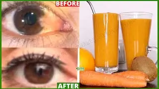 Drink This for STRONGER Eyesight And Get Better Vision | Home remedy to improve eyesight
