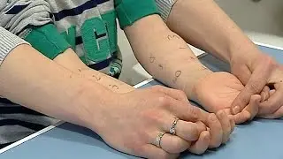 Kolejki do alergologów, sezon uczuleniowy trwa
