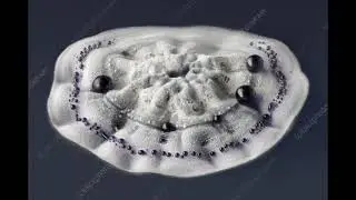 Petri Dish Earth Streptomyces Coelicolor