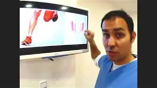 &iquest;Qu&eacute; es la periostitis tibial?