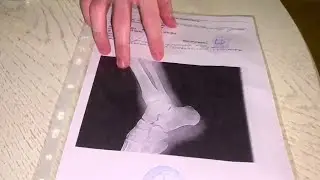 Упал?