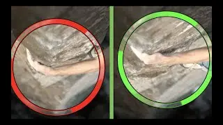 Carpal Tunnel Syndrome - Rock Climbing Movement Education
