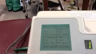 Conventional tens on cps