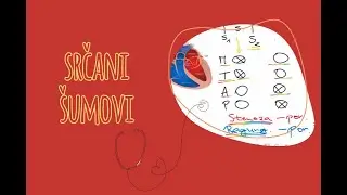 Auskultacija srca: Teorija o &scaron;umovima - stenoze i regurgitacije zalistaka
