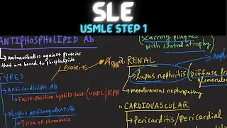 Systemic Lupus Erythematosus | SLE | Pathology | USMLE Step 1