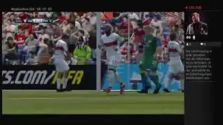 PS4-Live-&Uuml;bertragung von Fusselbart