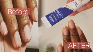 THE EASIEST WAY TO GROW LONG & STRONG NAILS!!! (Using a Premium Nail Care Cream)