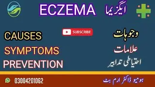 ECZEMA #dermatitis #inflammation #itch #immunesystem #asthma #hayfever #allergies #anxiety #stress .