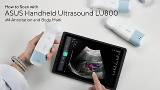 【ASUS Handheld Ultrasound LU800 Tutorial】#4 Annotation & Body Mark