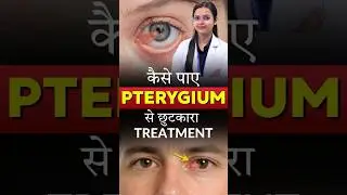 How to Get Rid of Pterygium? | Best Treatment Options